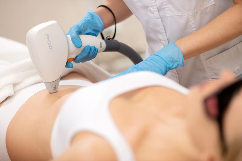 Lāzerepilācija vēdera baltajai līnijai (sievietēm) GRAND LUMENI