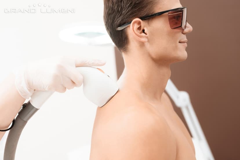 Lāzerepilācija pleciem (vīriešiem) salonā GRAND LUMENI
