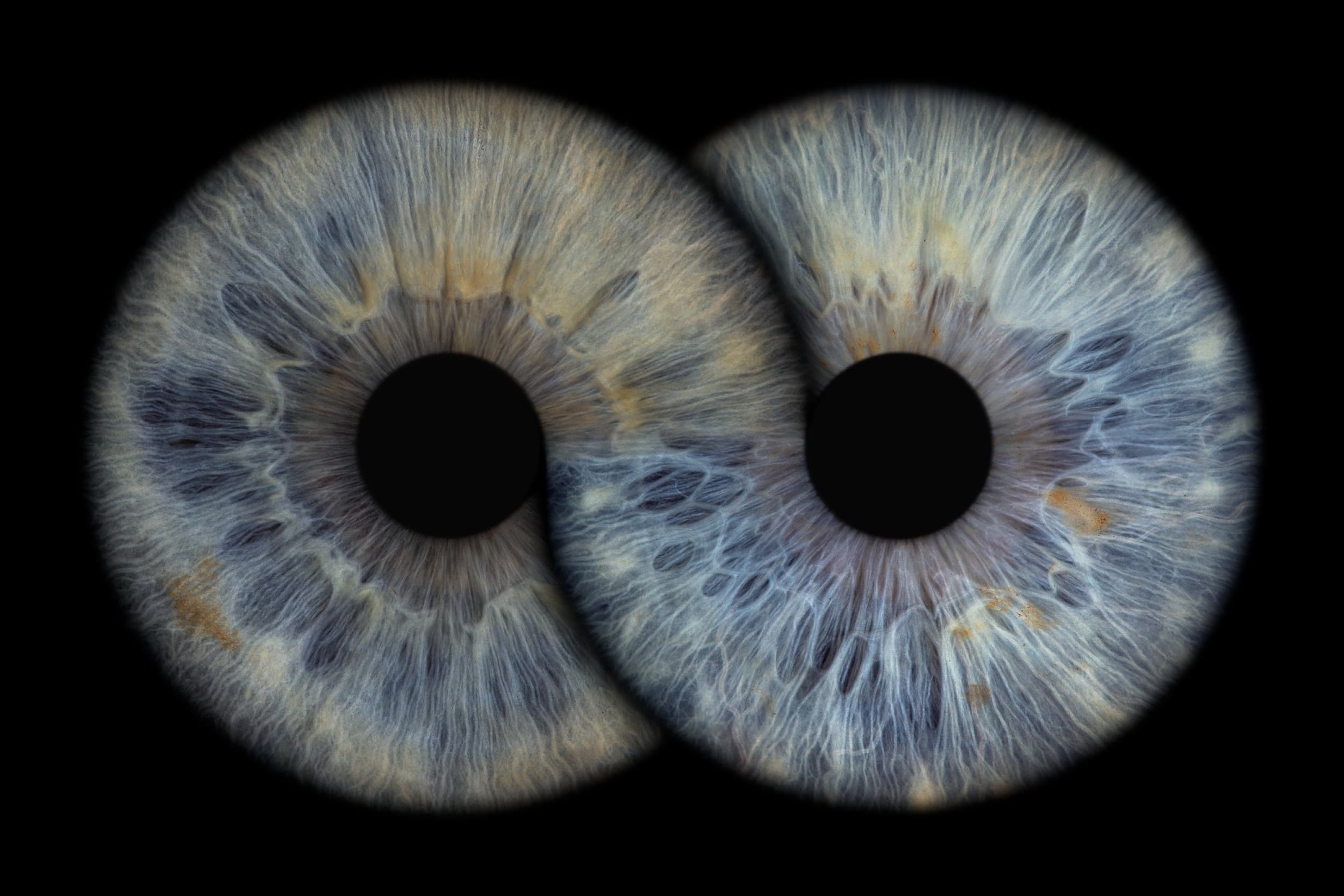 Digitāls acs fotoattēls "ViiEye" studijā | Davanu Serviss