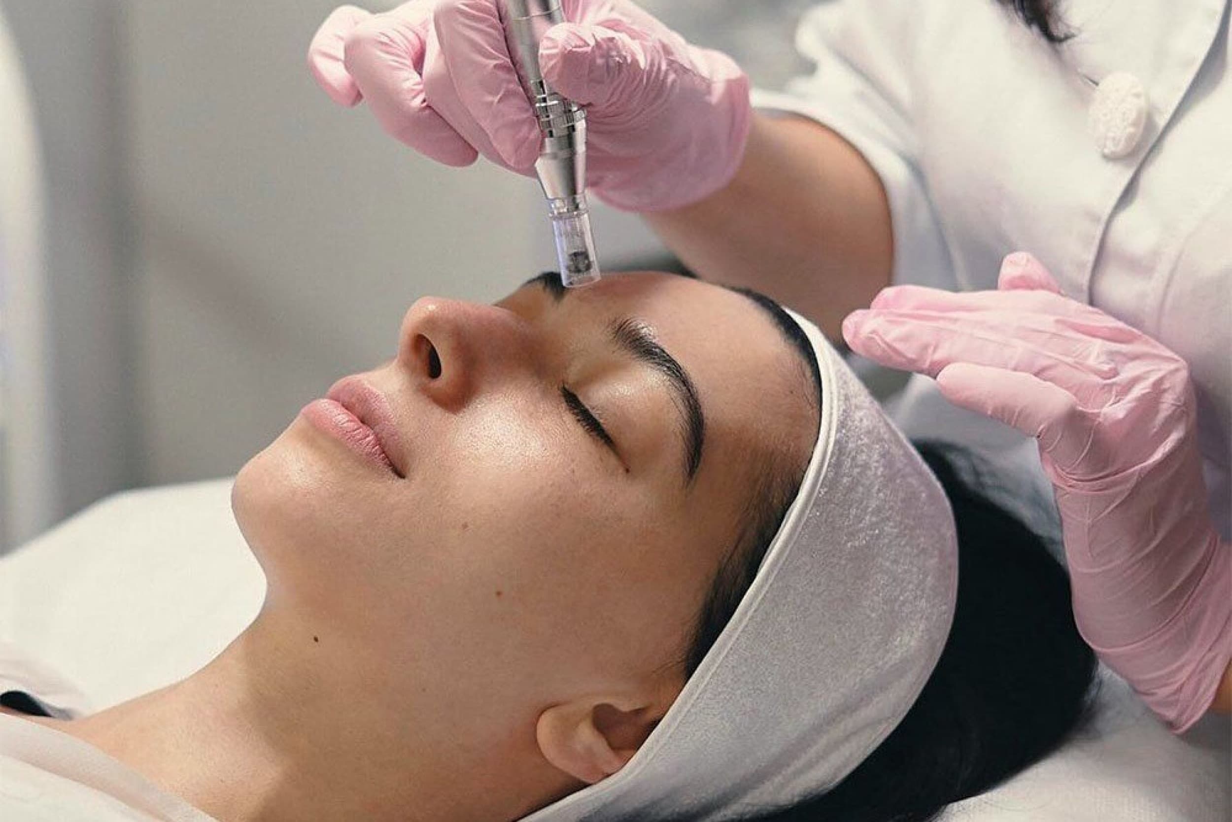 Microneedling sejai, kaklam, dekoltē + pīlings dāvanā | Davanu Serviss